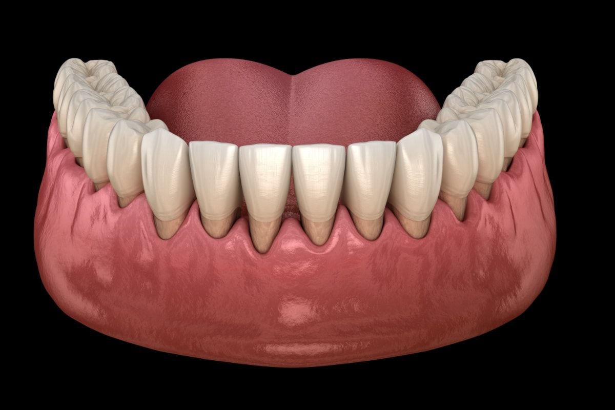Cirugia Periodontal Cirugia Oral Vilchez