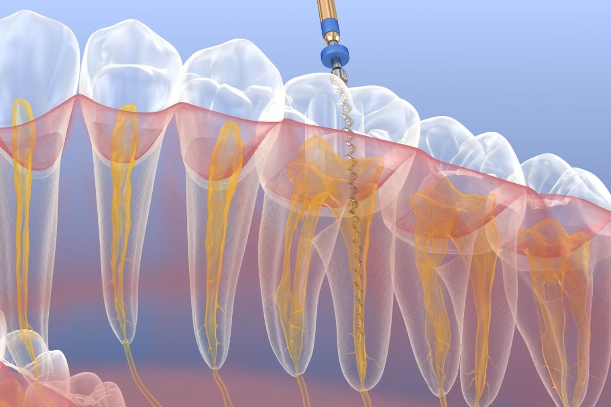 Endodoncia Cirugia Oral Vilchez